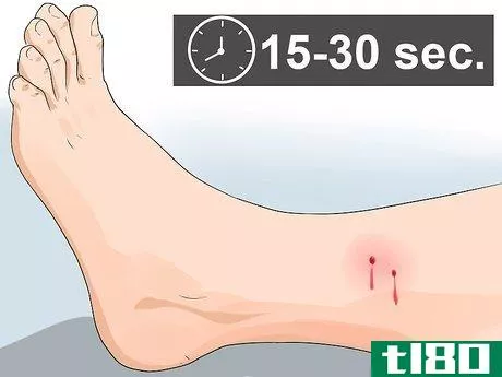 Image titled Apply a Pressure Bandage Step 15