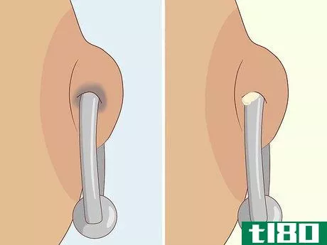 Image titled Care for a Nipple Piercing Step 4