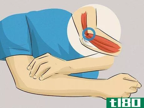 Image titled Assess Forearm Tendinitis Step 3
