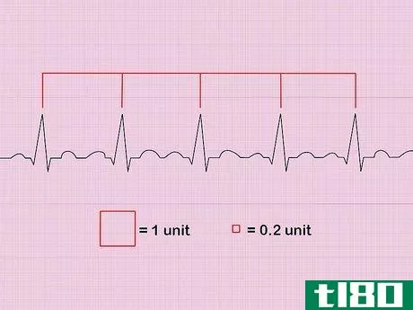 Image titled Calculate Heart Rate from ECG Step 3