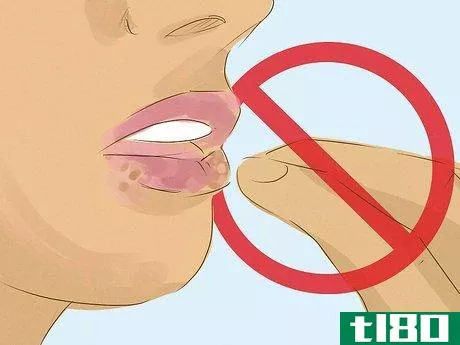 Image titled Date a Girl With Herpes Step 6
