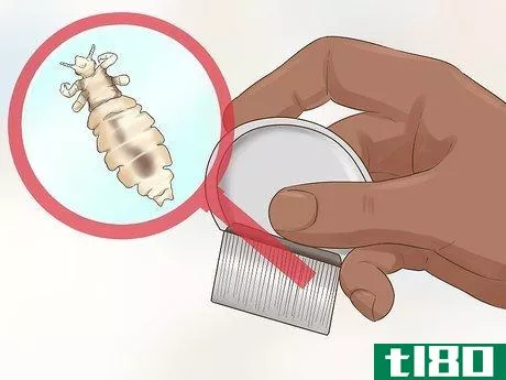 Image titled Check a Child's Hair for Lice Step 7