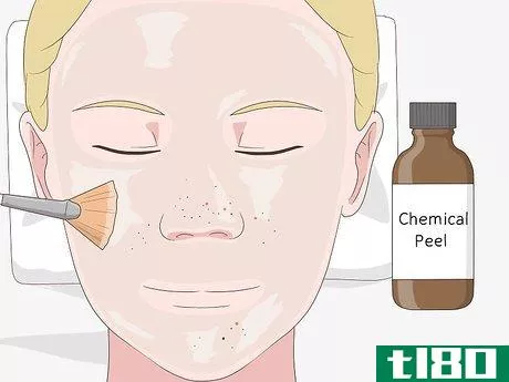 Image titled Clean Clogged Pores Step 4