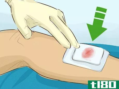 Image titled Stop Bleeding Step 19
