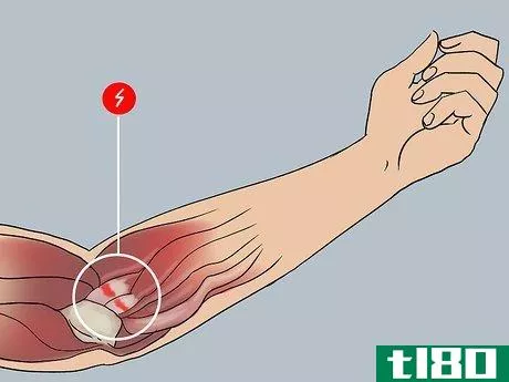 Image titled Cure Forearm Pain Step 4