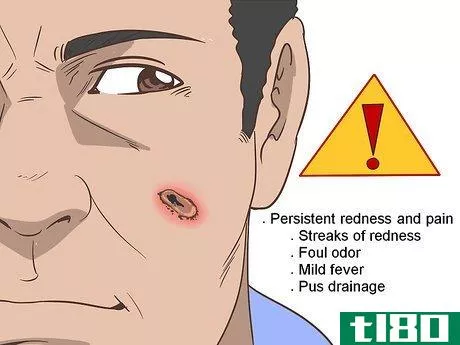 Image titled Heal Scabs on Your Face Step 8