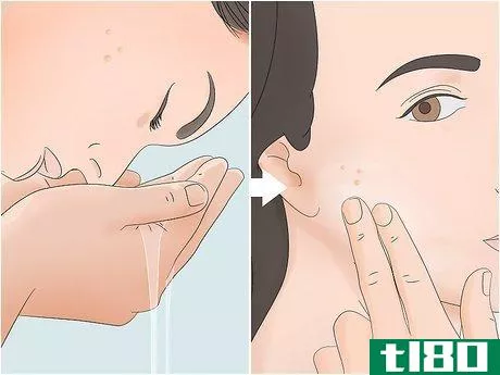 Image titled Clear Pustules on Your Face Step 2