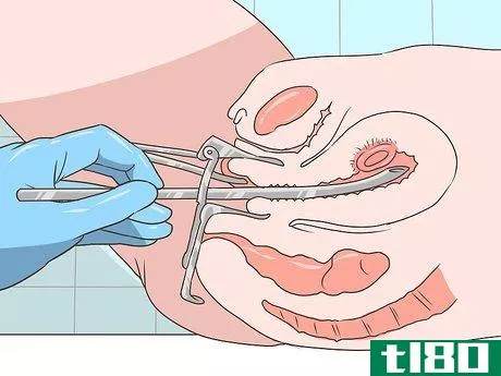 Image titled Decide Whether or Not to Get an Abortion Step 5