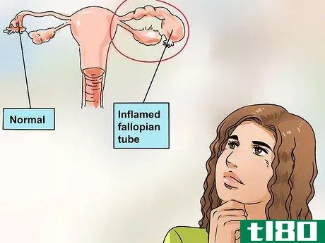 Image titled Cure Vaginal Infections Without Using Medications Step 10