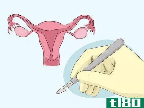 Image titled Decide Whether or Not to Have Preventive Breast Surgery Step 8