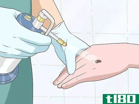 Image titled Check for Skin Cancer Step 7