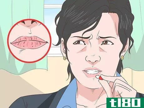 Image titled Prevent Dry Chapped Lips Step 13