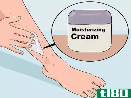 Image titled Get Rid of a Rash from Nair Step 4