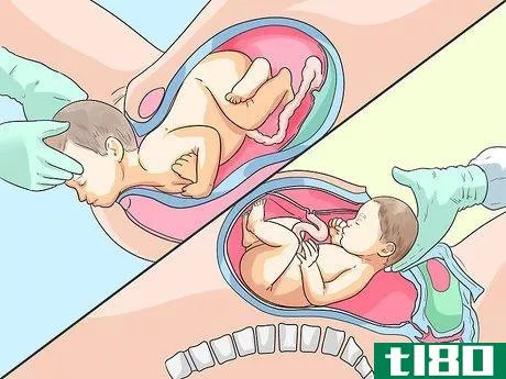 Image titled Decide Where to Deliver Your Baby Step 1