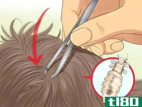 Image titled Check a Child's Hair for Lice Step 13