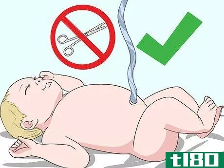 Image titled Cut the Umbilical Cord of a Baby Step 1
