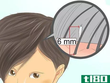 Image titled Check a Child's Hair for Lice Step 6