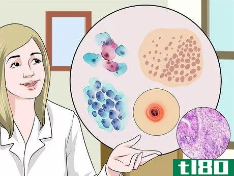 Image titled Deal with an Abnormal Pap Smear Step 4