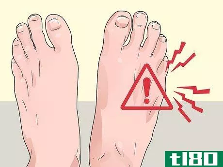 Image titled Check Feet for Complications of Diabetes Step 2