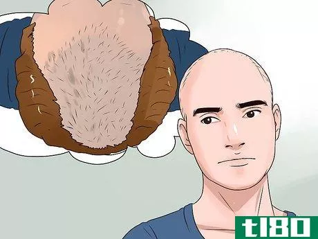 Image titled Choose the Right Hair Loss Option Step 13