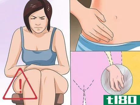 Image titled Treat a Yeast Infection Step 1
