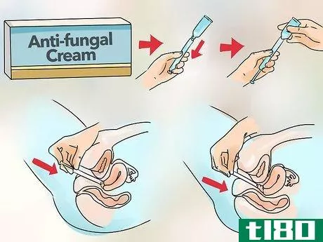 Image titled Cure Vaginal Infections Without Using Medications Step 27