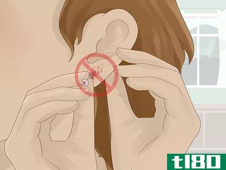 Image titled Clean an Infected Ear Piercing Step 2
