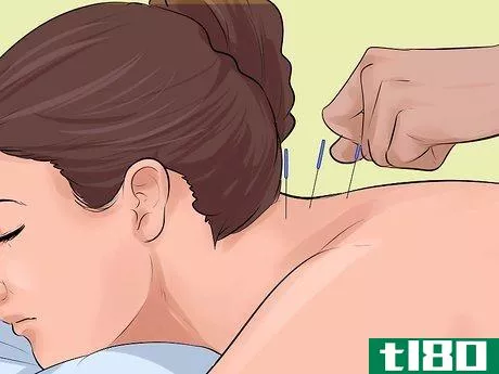 Image titled Use Physical Therapy to Recover From Whiplash Step 10