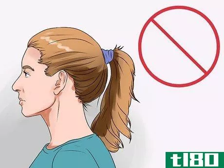 Image titled Choose the Right Hair Loss Option Step 8