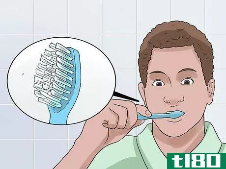 Image titled Clean Your Teeth After Wisdom Teeth Removal Step 4