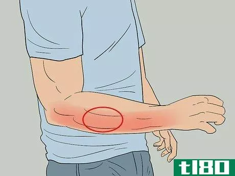 Image titled Cure Forearm Pain Step 5