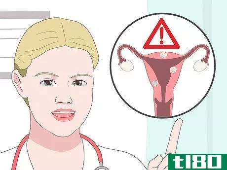 Image titled Deal with Fibroids During Pregnancy Step 6