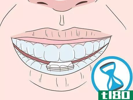 Image titled Cope with Teeth Whitening Sensitivity Step 7