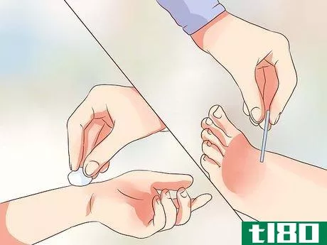 Image titled Conduct a Secondary Survey of an Injured Person Step 12