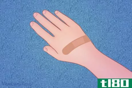 Image titled Child's Hand with Bandage.png