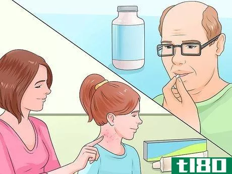 Image titled Cure Scabies Step 10