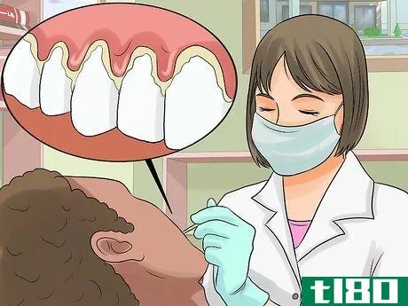 Image titled Stop Itchy Gums Step 10