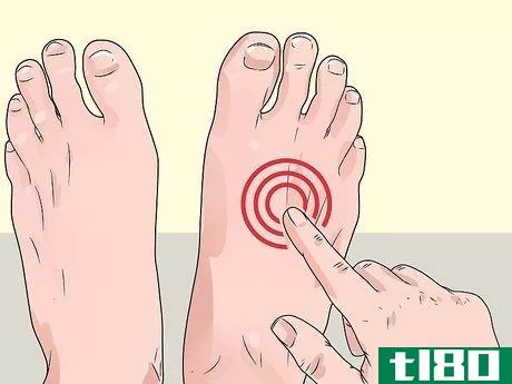 Image titled Check Feet for Complications of Diabetes Step 3
