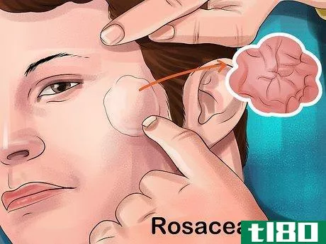 Image titled Choose Between Expert and Diy Beauty Treatments Step 1