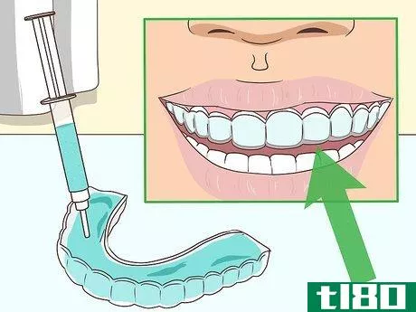 Image titled Cope with Teeth Whitening Sensitivity Step 3
