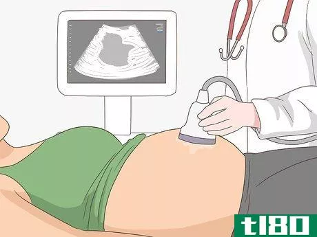 Image titled Deal with Fibroids During Pregnancy Step 1