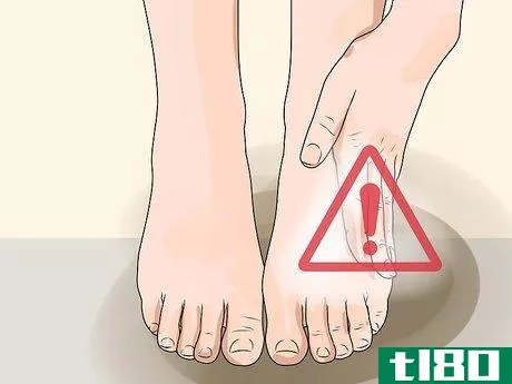 Image titled Check Feet for Complications of Diabetes Step 1