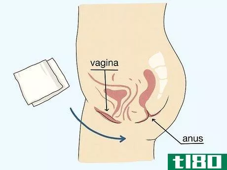 Image titled Control Vaginal Discharge Step 2