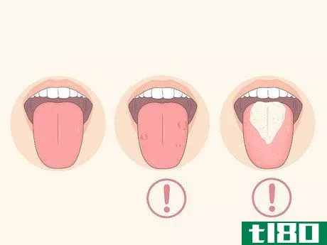 Image titled Clean Your Tongue Properly Step 1