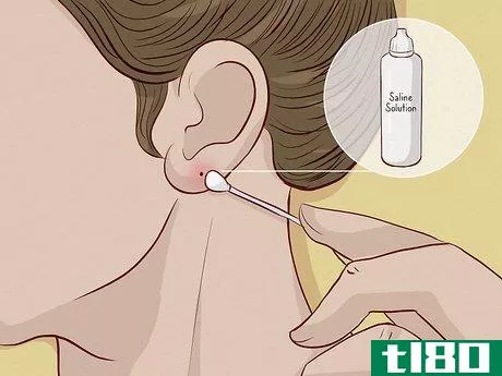 Image titled Close an Earlobe Piercing Step 2
