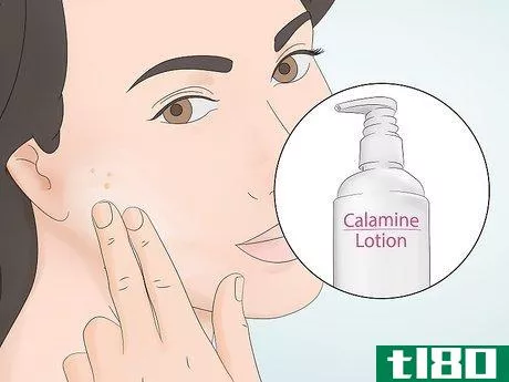Image titled Clear Pustules on Your Face Step 7