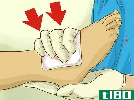 Image titled Stop Bleeding Step 18