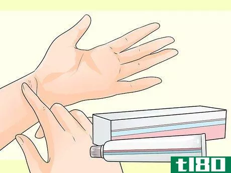 Image titled Cure Scabies Step 11