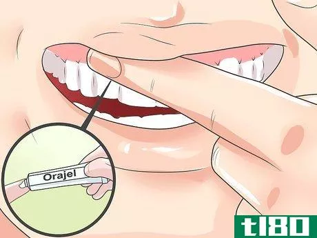 Image titled Deal With a Sore Tooth Step 5