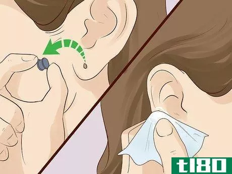Image titled Close Gauged Ears Step 4.jpeg